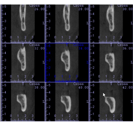 Esteti-Align, Slice - Radiologia e Tomografia Odontológica