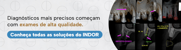 tomografia de feixe cônico